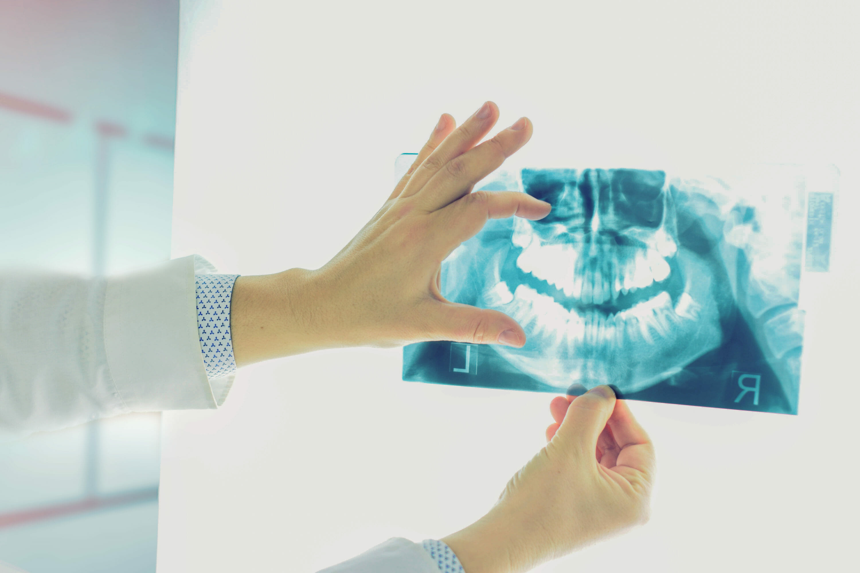 What Is Dental Bone Loss and Can It Be Reversed?