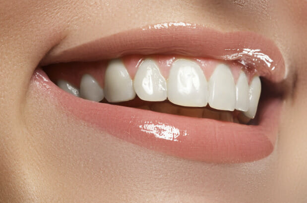 Orthodontic Treatment Has The Following Benefits: